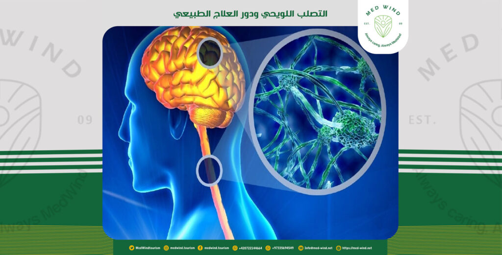 التصلب اللويحي