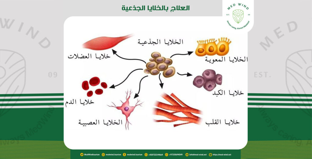العلاج بالخلايا الجذعية