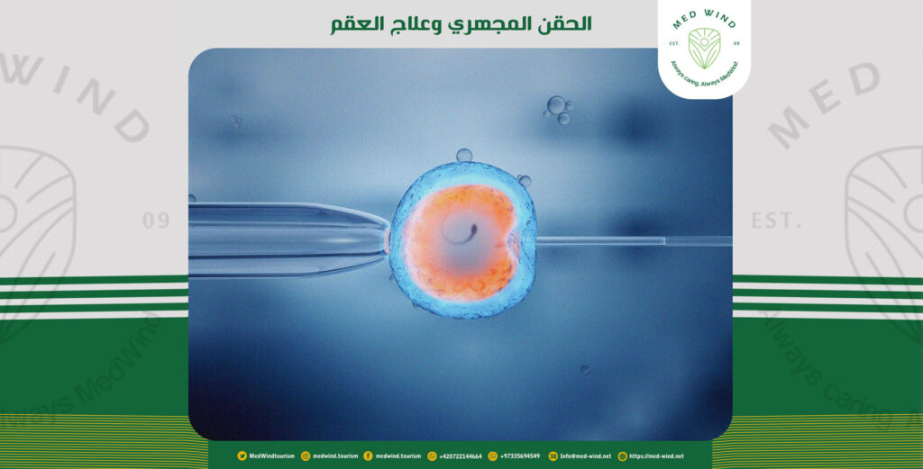 علاج العقم